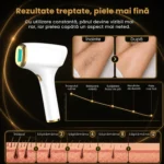 Epilator IPL cu răcire W-1101, 9 niveluri și afișaj digital - imagine 8