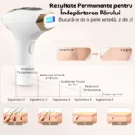 Fotoepilator IPL cu răcire pentru epilare acasă - imagine 7